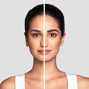 Before and After 1