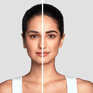 Before and After 3
