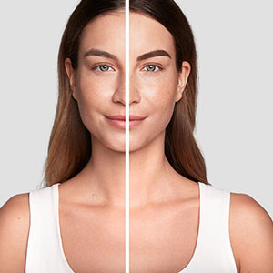 Before and After 4
